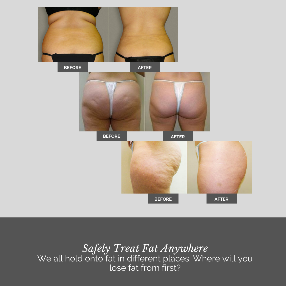 The Nushape Lipo Wrap for Fat Loss - LEDPhototherapies