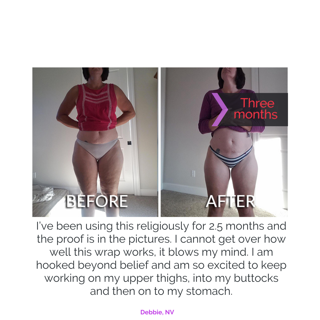 The Nushape Lipo Wrap for Fat Loss - LEDPhototherapies