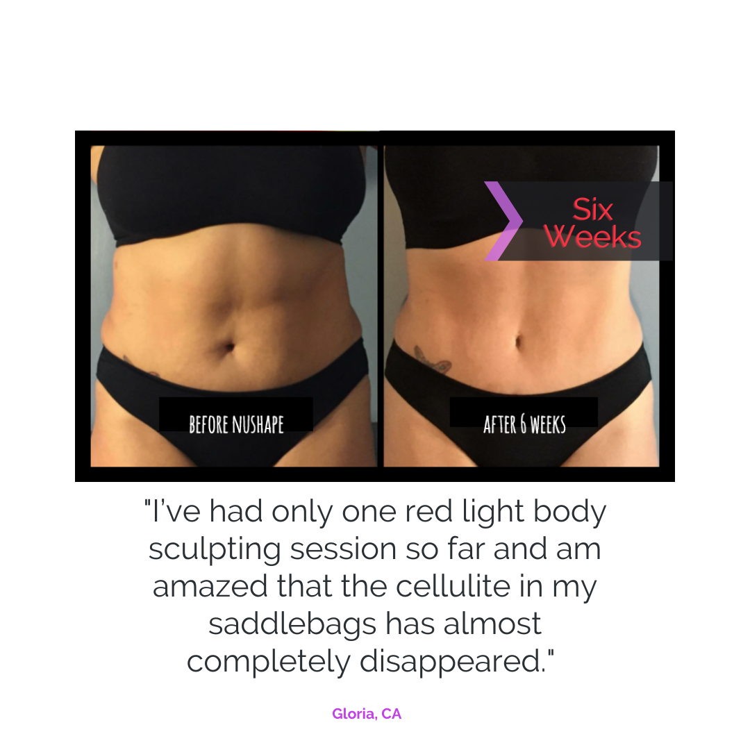 The Nushape Lipo Wrap for Fat Loss - LEDPhototherapies